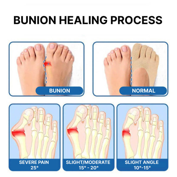Orthopedic Bunion-Relief Socks