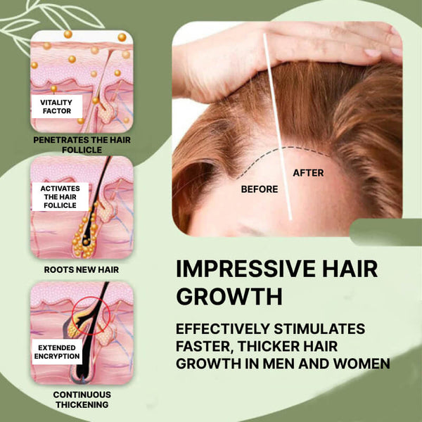 Herbal Hair Growth Serum