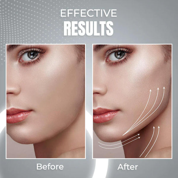 Facial and Neck Wrinkle Anti-Aging Device EMS - HealthCare