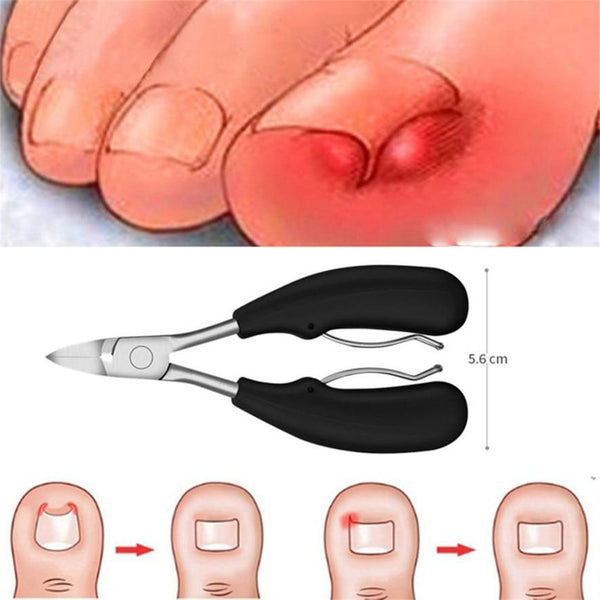 Nail clippers for ingrown nails